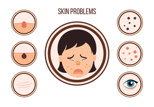 Ayurvedic Homemade Remedies for Skin Conditions Nutrixia Food