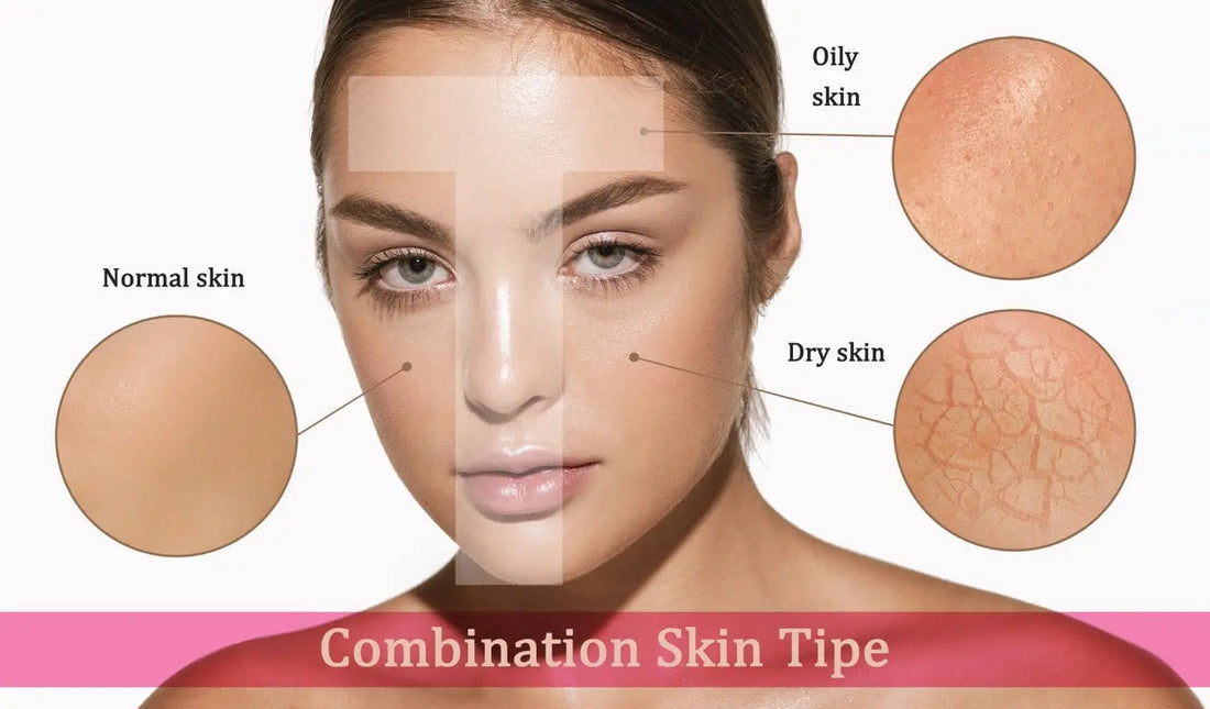what are ayurvedic products and their homemade remedies to treat oily skin Nutrixia Food